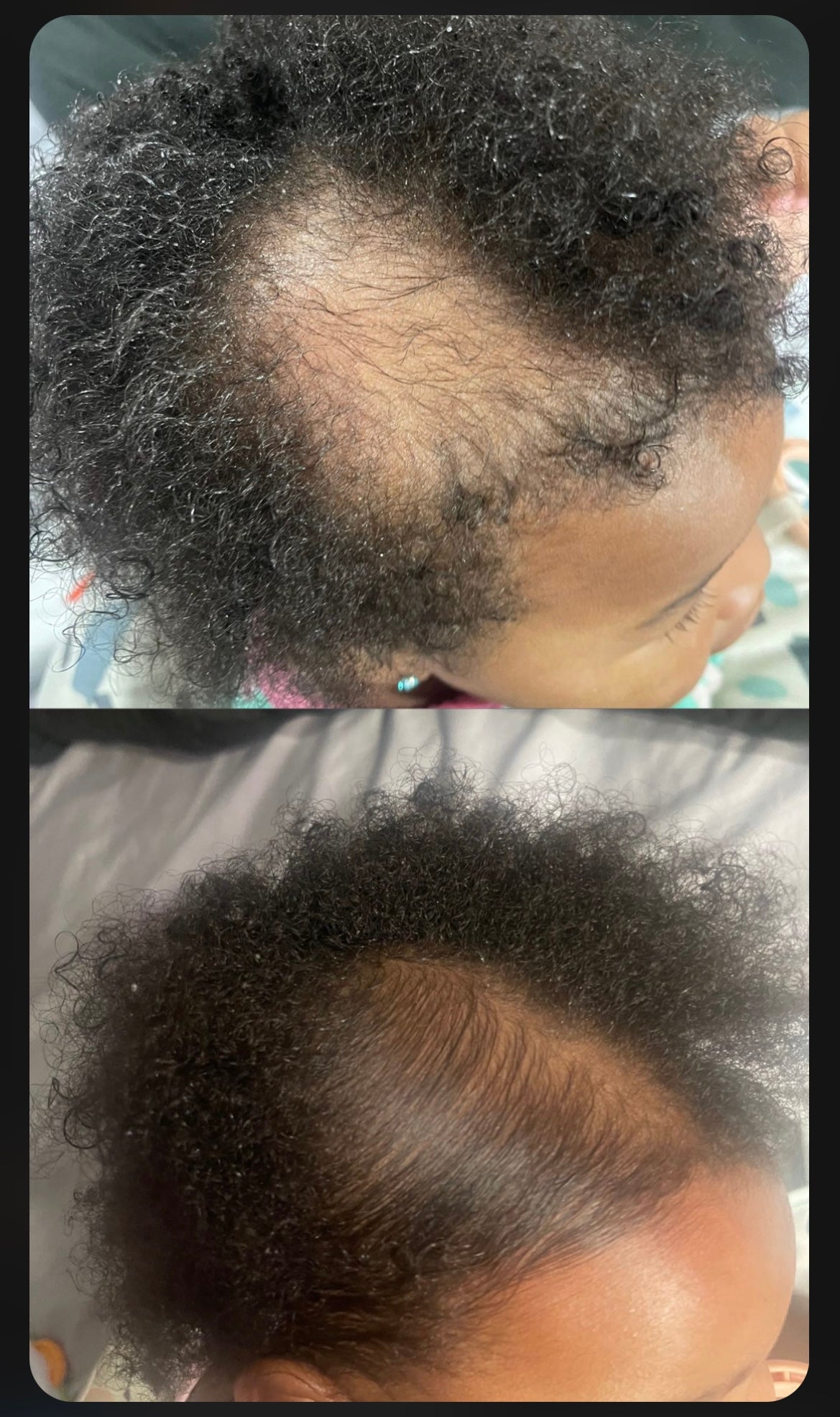 Super Hair Growth Oil 4 oz
