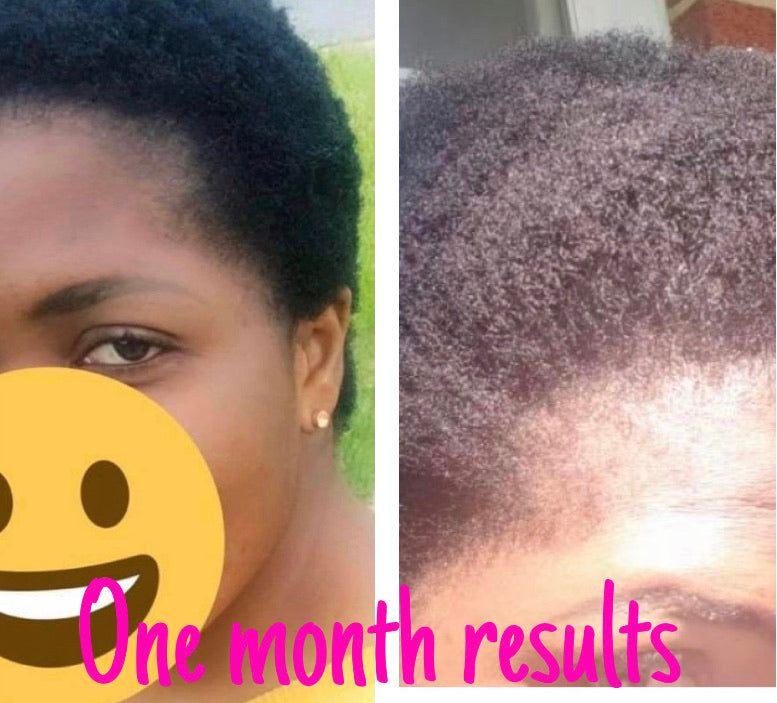 Super Hair Growth Oil 2 oz